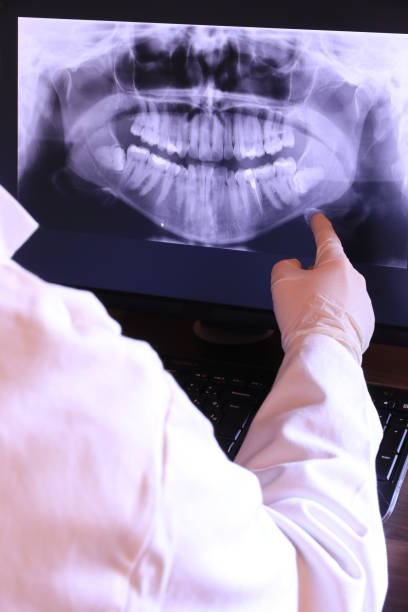 Best Emergency Dental Care for Broken or Chipped Teeth in North New Hyde Park, NY