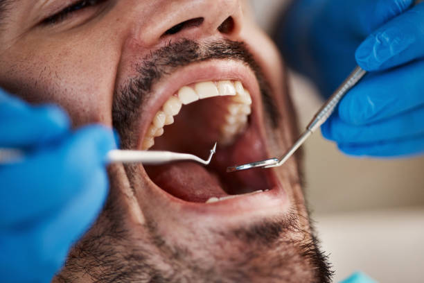 Best Emergency Treatment for Dental Infections or Abscesses in North New Hyde Park, NY