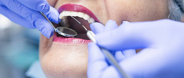 Best Urgent Care for Lost Fillings or Crowns in North New Hyde Park, NY